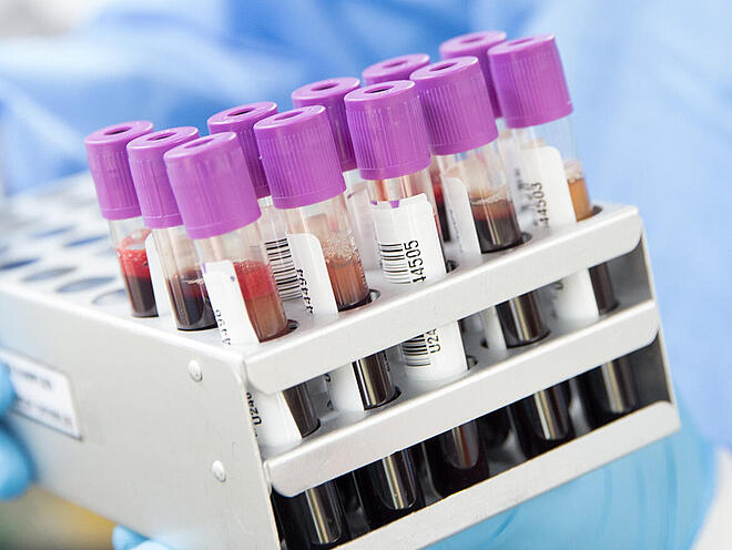 使用 AAS 或 ICP-MS 对体液中的元素进行定量